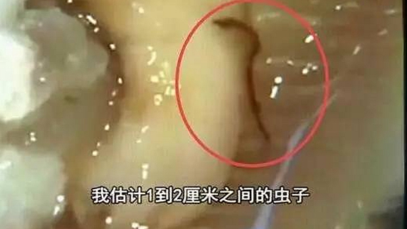 一只生蠔引起的冤案，觸動(dòng)了餐飲人的“麻木神經(jīng)”